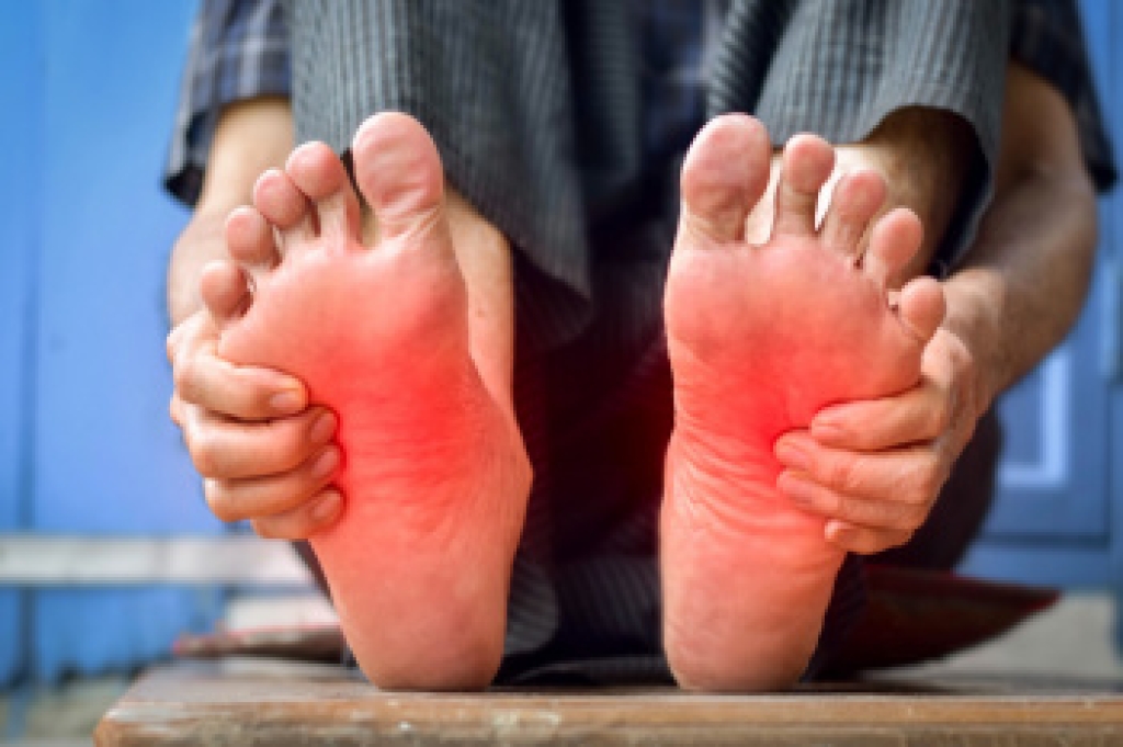 Adapting Running Techniques for Foot Arthritis Relief