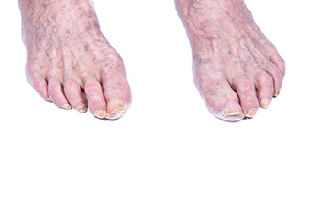 The Importance of Foot Care for Aging Feet