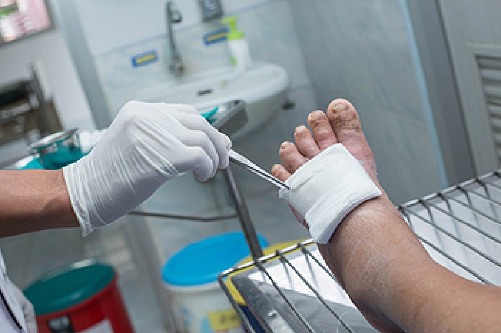 Diabetic and Non-Diabetic Foot Ulcers Explained