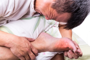 Do I Have Gout?